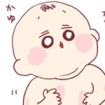 【赤ちゃんの湿疹】あーちゃんと母の攻防戦はどこまでも…