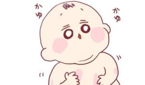【赤ちゃんの湿疹】あーちゃんと母の攻防戦はどこまでも…